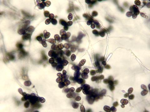 Ulocladium_sp_4