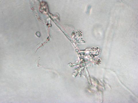 Sclerotium cepivorum conidiophores